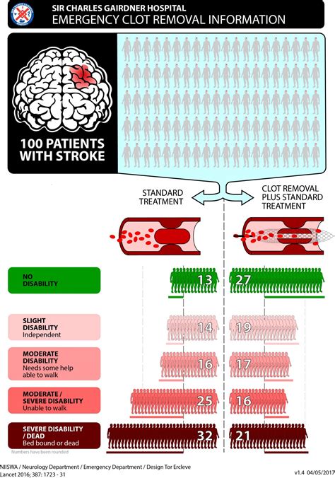 lvo means in stroke.